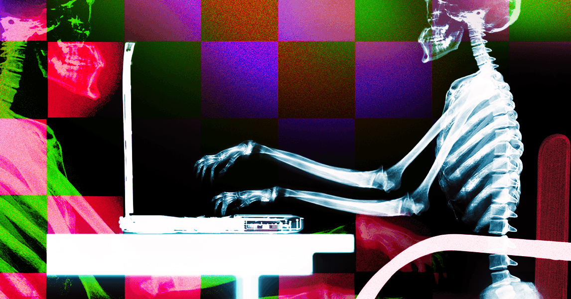 How to Prevent Tech Neck and Sit Properly With Your Laptop (2025)